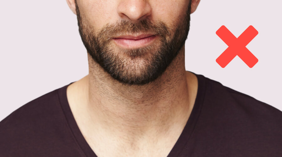 Common Mistakes to Steer Clear of When Using Minoxidil for Beard Growth
