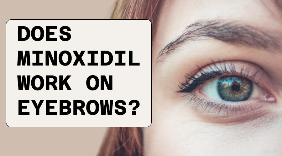 Does Minoxidil Work on Eyebrows?